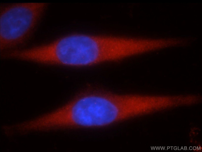 STK4/MST1 Antibody in Immunocytochemistry (ICC/IF)