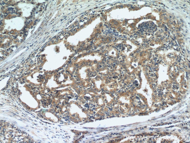 STK4/MST1 Antibody in Immunohistochemistry (Paraffin) (IHC (P))