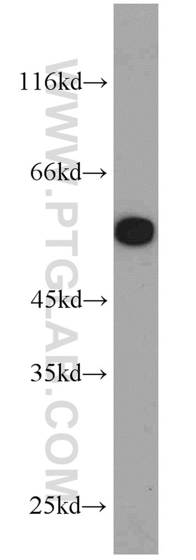 STK4/MST1 Antibody in Western Blot (WB)