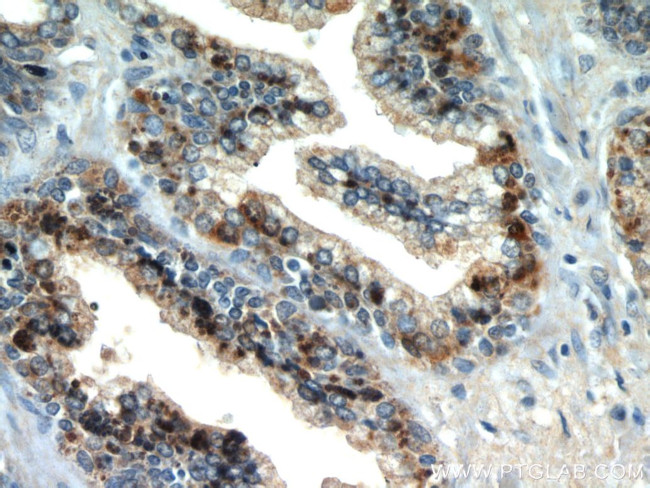 STK4/MST1 Antibody in Immunohistochemistry (Paraffin) (IHC (P))