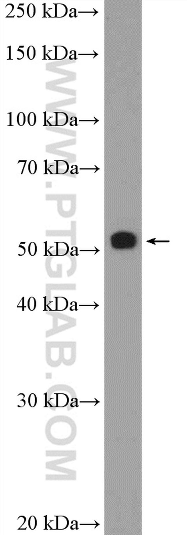 STK4/MST1 Antibody in Western Blot (WB)