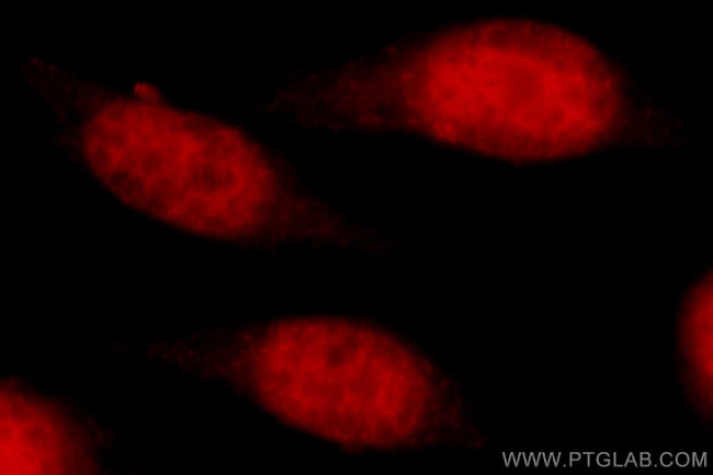 TBP Antibody in Immunocytochemistry (ICC/IF)