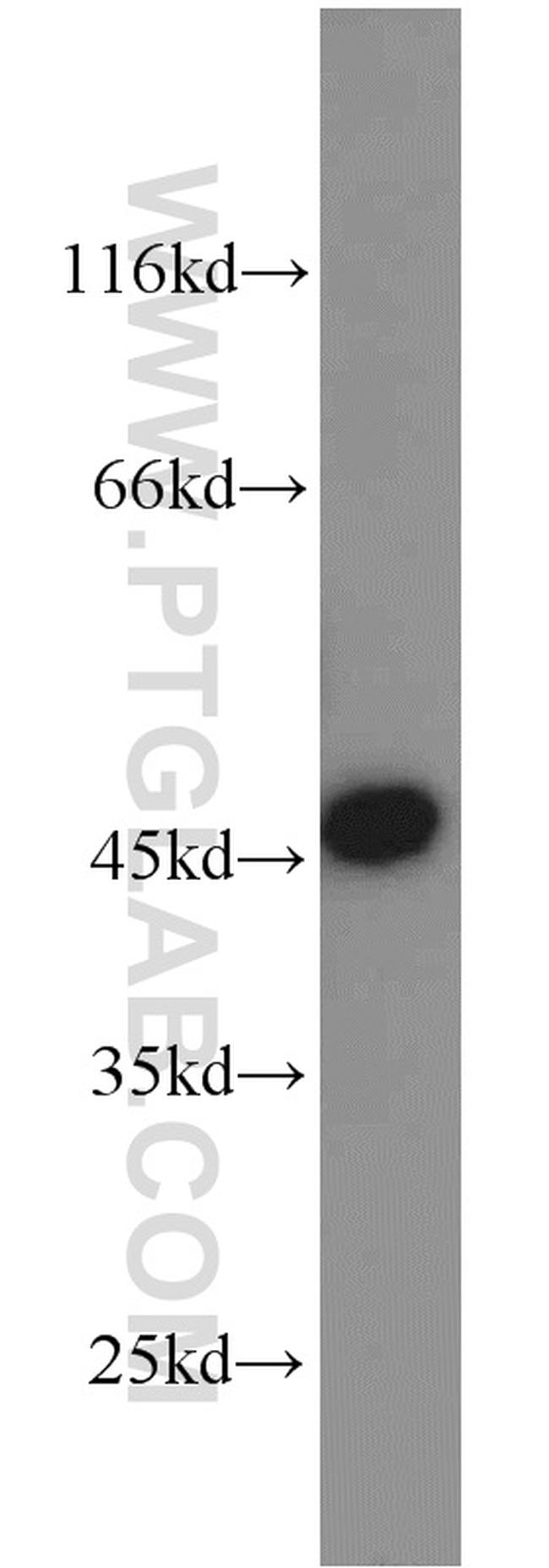 TBP Antibody in Western Blot (WB)