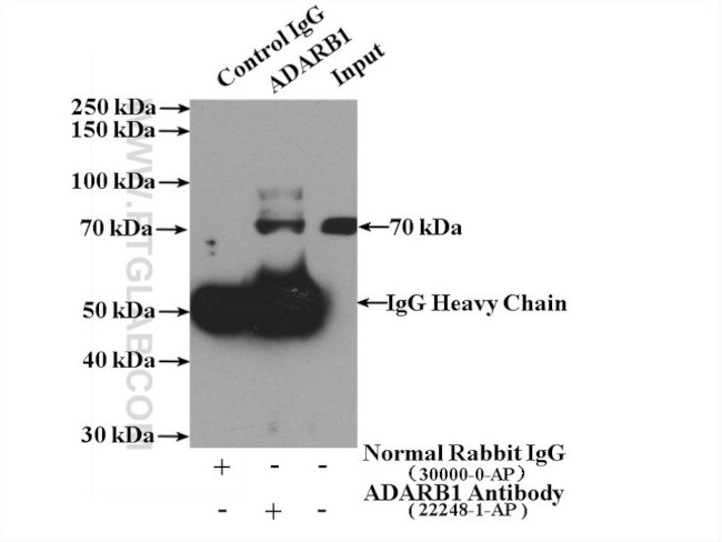 ADARB1 Antibody in Immunoprecipitation (IP)