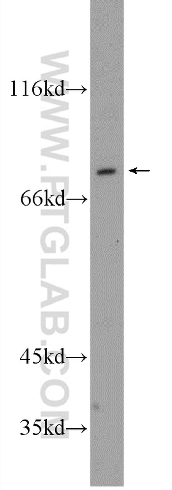 ADARB1 Antibody in Western Blot (WB)