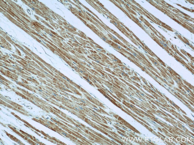 TNNI1 Antibody in Immunohistochemistry (Paraffin) (IHC (P))