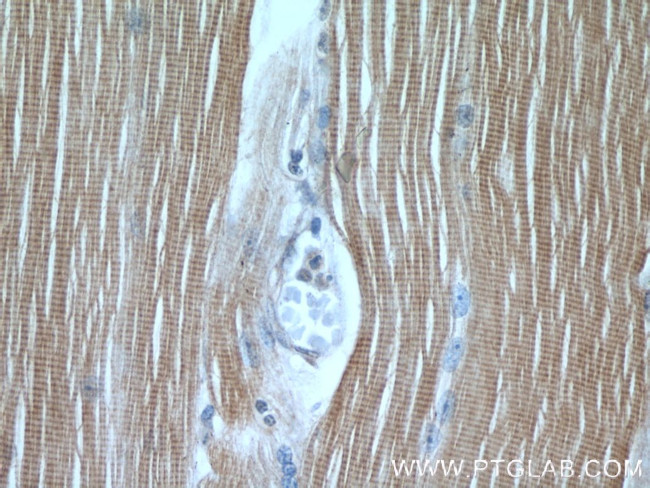 TNNI1 Antibody in Immunohistochemistry (Paraffin) (IHC (P))