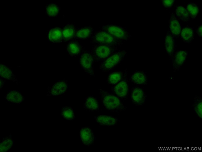 ASF1B Antibody in Immunocytochemistry (ICC/IF)