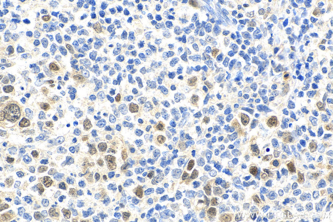 ASF1B Antibody in Immunohistochemistry (Paraffin) (IHC (P))