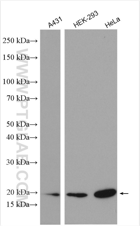 ASF1B Antibody in Western Blot (WB)