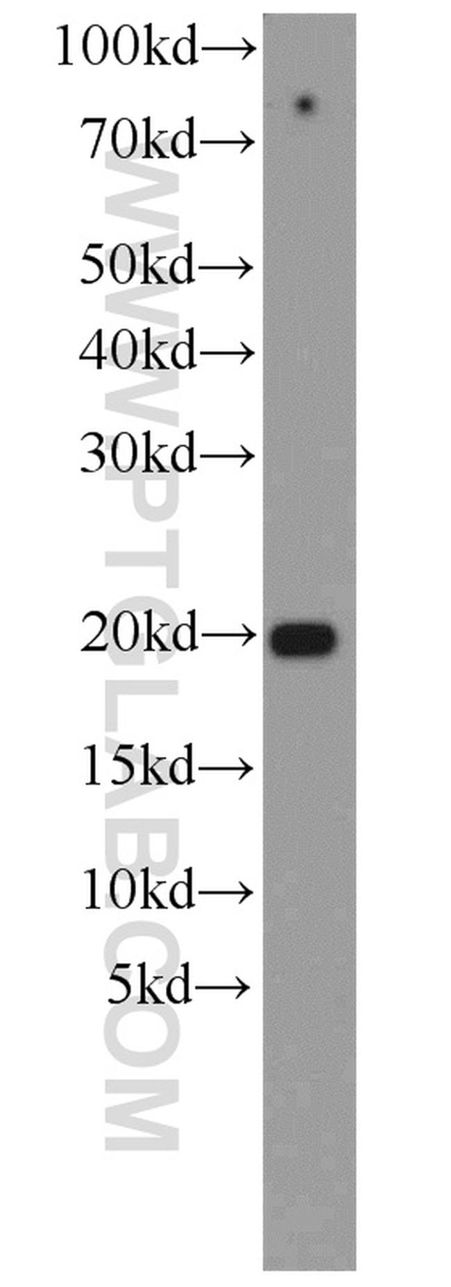 ASF1B Antibody in Western Blot (WB)