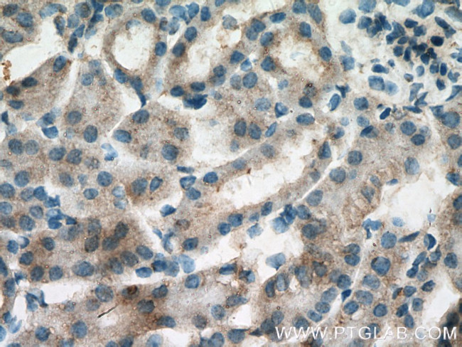 Polycystin 1 Antibody in Immunohistochemistry (Paraffin) (IHC (P))