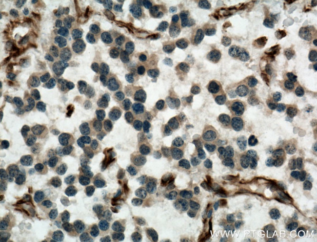 SACS Antibody in Immunohistochemistry (Paraffin) (IHC (P))