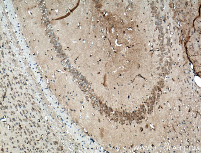 SACS Antibody in Immunohistochemistry (Paraffin) (IHC (P))