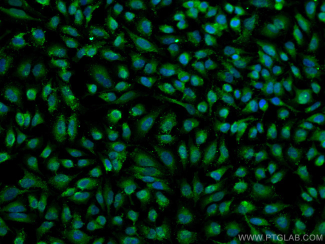 VAMP7/TI-VAMP Antibody in Immunocytochemistry (ICC/IF)