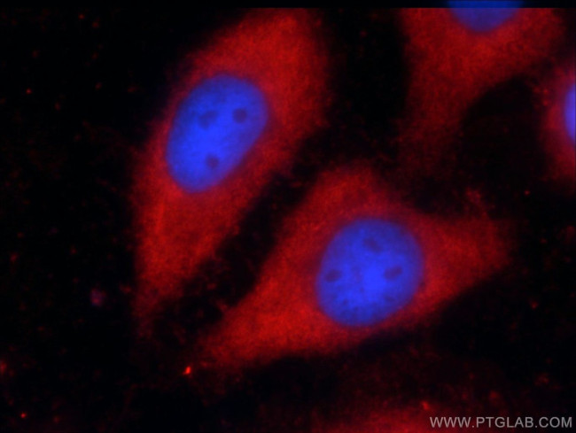 VAMP7/TI-VAMP Antibody in Immunocytochemistry (ICC/IF)