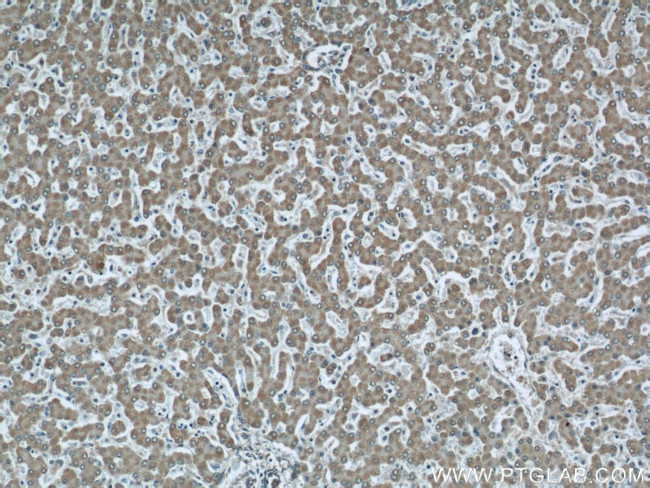 VAMP7/TI-VAMP Antibody in Immunohistochemistry (Paraffin) (IHC (P))