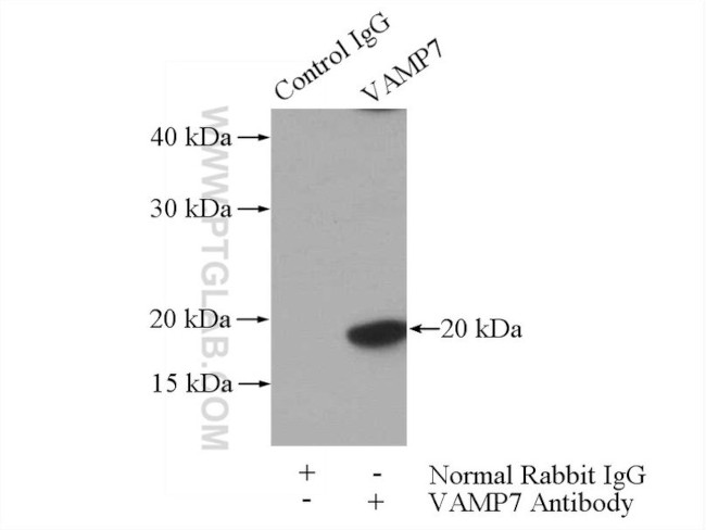 VAMP7/TI-VAMP Antibody in Immunoprecipitation (IP)