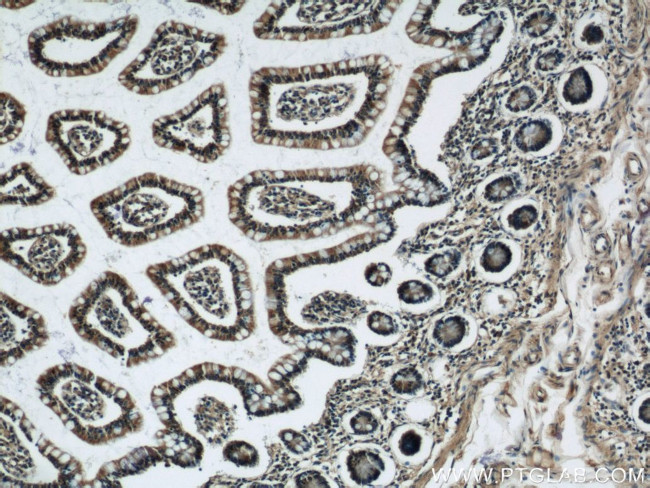 VAMP7/TI-VAMP Antibody in Immunohistochemistry (Paraffin) (IHC (P))