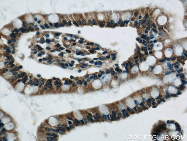 VAMP7/TI-VAMP Antibody in Immunohistochemistry (Paraffin) (IHC (P))