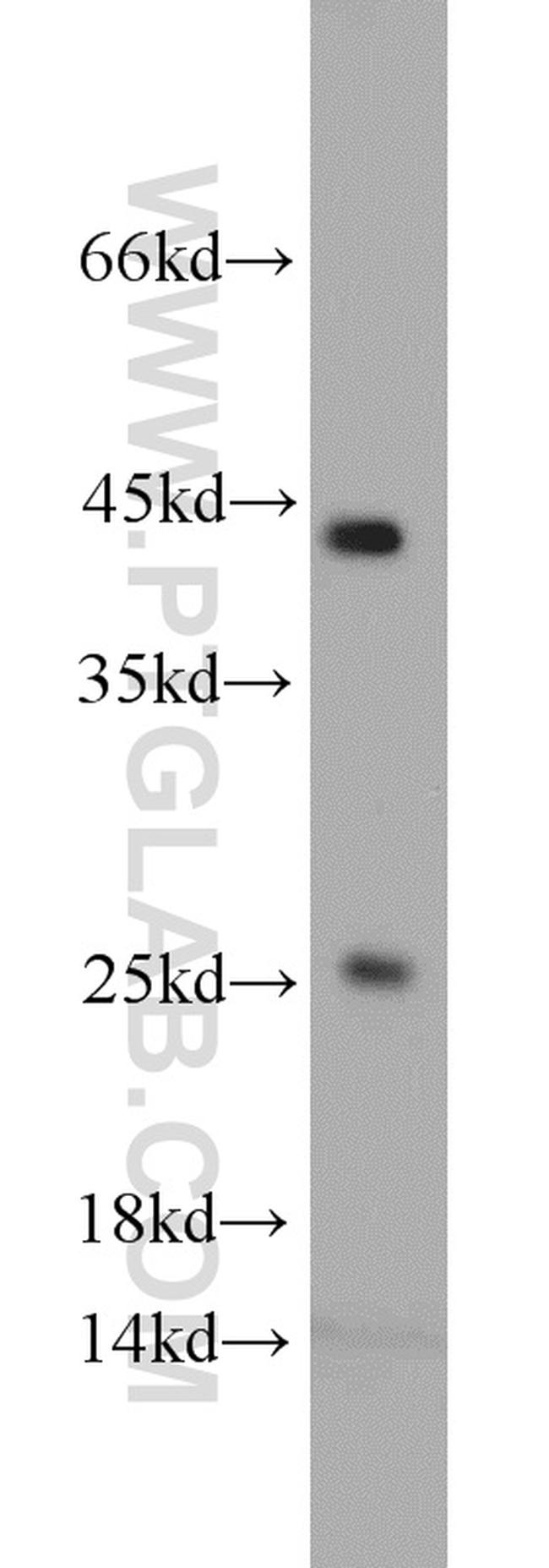 VAMP7/TI-VAMP Antibody in Western Blot (WB)