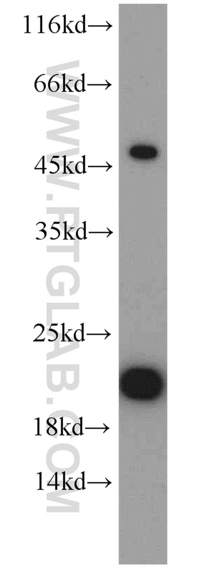 VAMP7/TI-VAMP Antibody in Western Blot (WB)