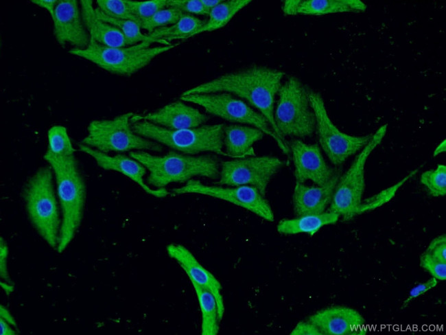 CACNA1D Antibody in Immunocytochemistry (ICC/IF)