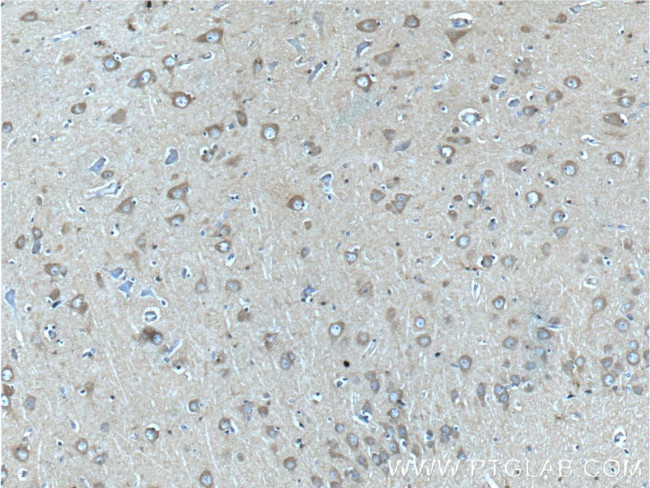 CACNA1D Antibody in Immunohistochemistry (Paraffin) (IHC (P))
