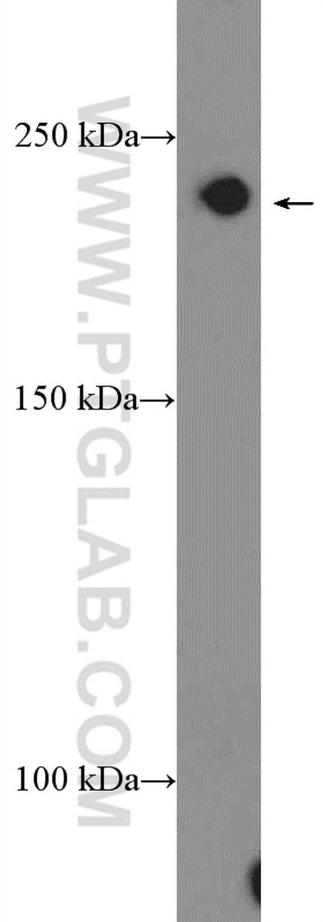 CACNA1D Antibody in Western Blot (WB)