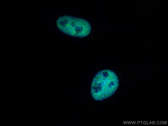 CREBBP Antibody in Immunocytochemistry (ICC/IF)