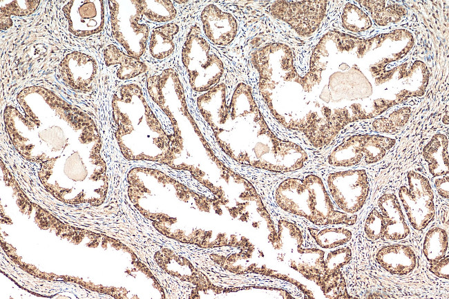 CREBBP Antibody in Immunohistochemistry (Paraffin) (IHC (P))