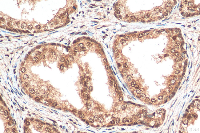 CREBBP Antibody in Immunohistochemistry (Paraffin) (IHC (P))