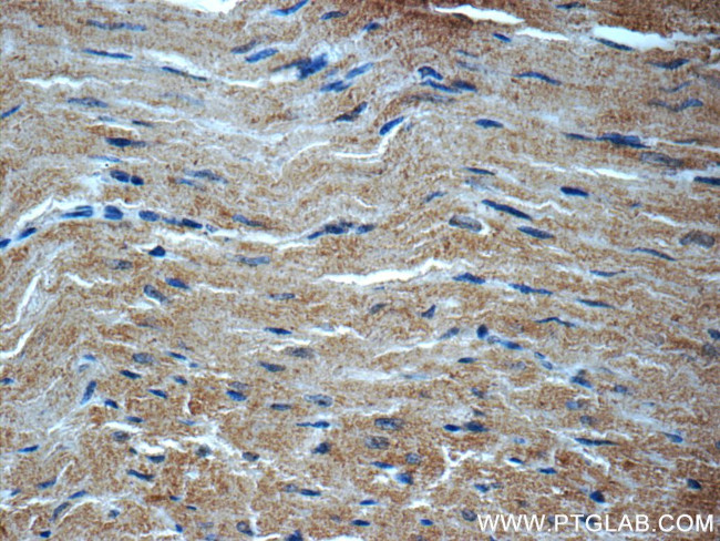 MYH7 Antibody in Immunohistochemistry (Paraffin) (IHC (P))