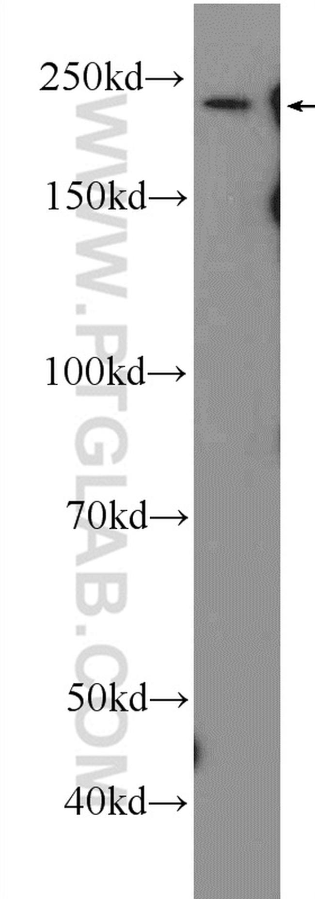 MYH7 Antibody in Western Blot (WB)