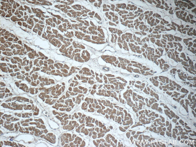 MYH6 Antibody in Immunohistochemistry (Paraffin) (IHC (P))