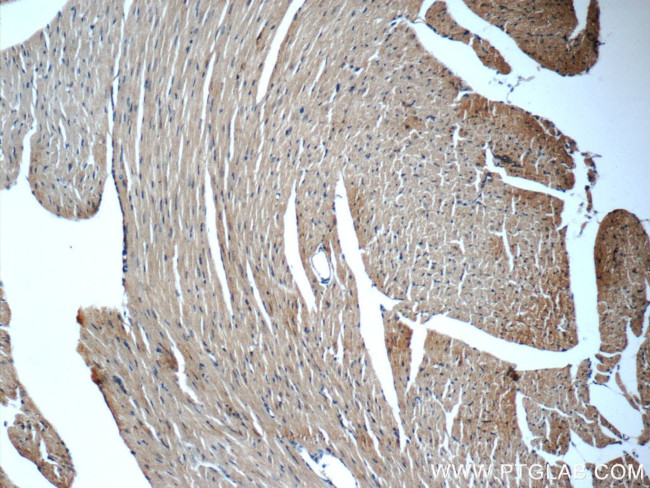 MYH6 Antibody in Immunohistochemistry (Paraffin) (IHC (P))