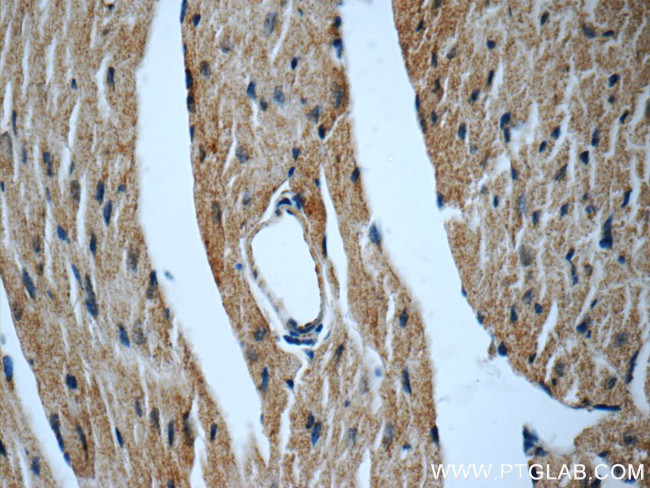 MYH6 Antibody in Immunohistochemistry (Paraffin) (IHC (P))