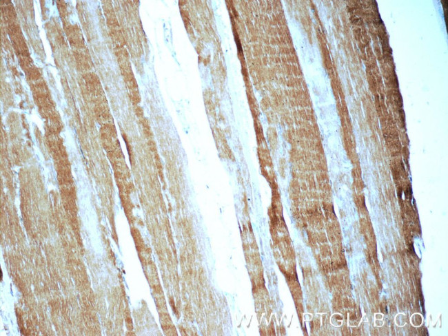 MYH1-internal Antibody in Immunohistochemistry (Paraffin) (IHC (P))