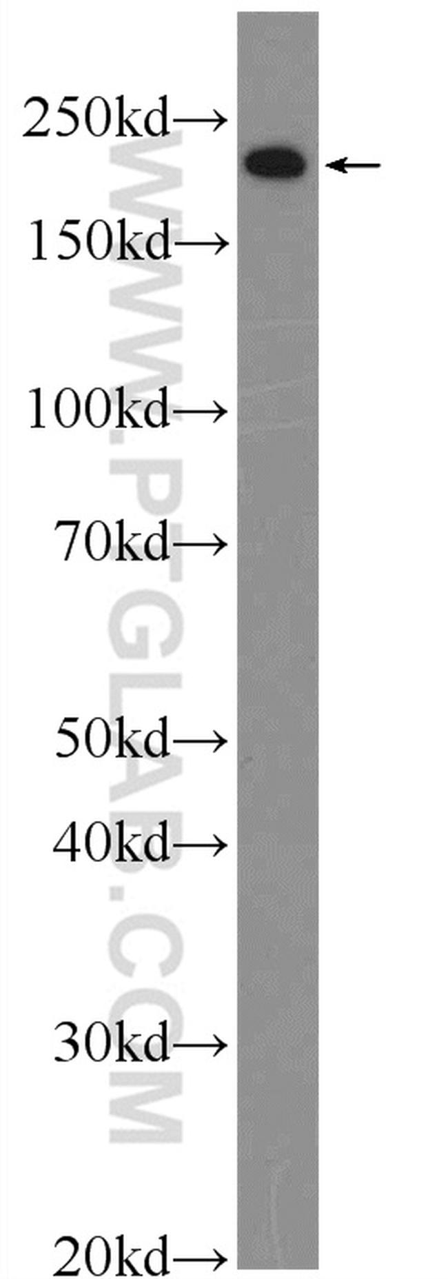 MYH3 Antibody in Western Blot (WB)