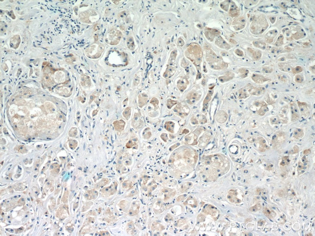 ARF3 Antibody in Immunohistochemistry (Paraffin) (IHC (P))