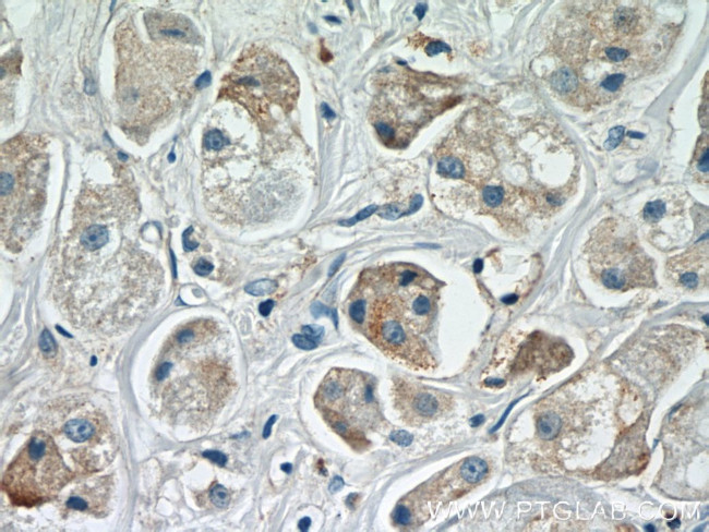 ARF3 Antibody in Immunohistochemistry (Paraffin) (IHC (P))