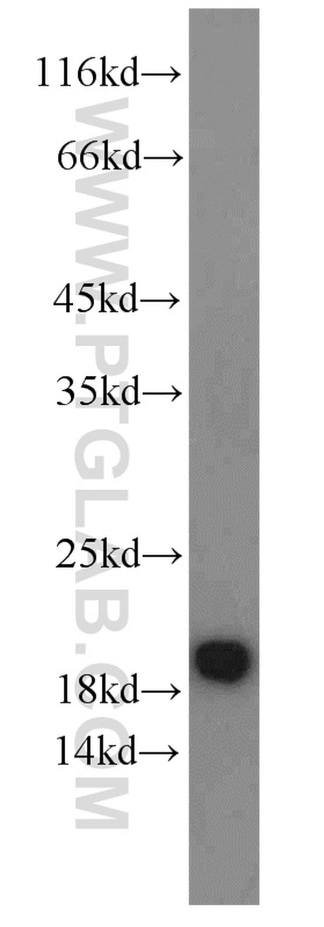 ARF3 Antibody in Western Blot (WB)