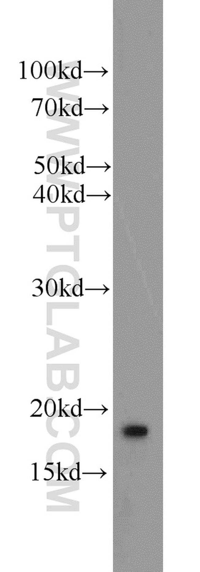 ARF3 Antibody in Western Blot (WB)