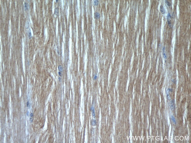 SAR1B Antibody in Immunohistochemistry (Paraffin) (IHC (P))