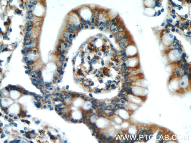 SAR1B Antibody in Immunohistochemistry (Paraffin) (IHC (P))