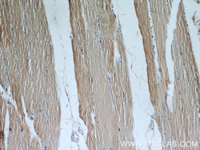 SAR1B Antibody in Immunohistochemistry (Paraffin) (IHC (P))