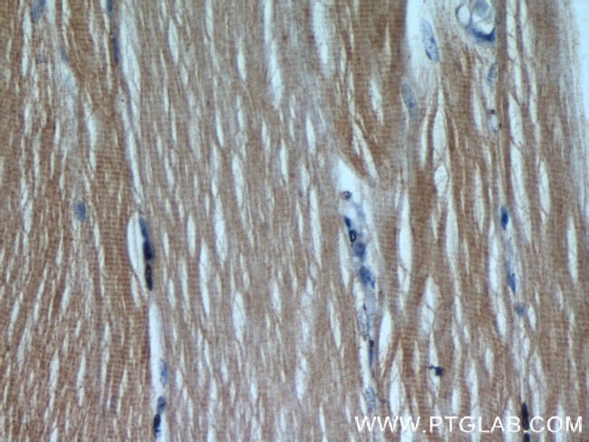 SAR1B Antibody in Immunohistochemistry (Paraffin) (IHC (P))