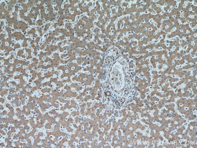 SAR1B Antibody in Immunohistochemistry (Paraffin) (IHC (P))