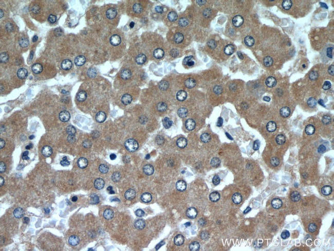 SAR1B Antibody in Immunohistochemistry (Paraffin) (IHC (P))