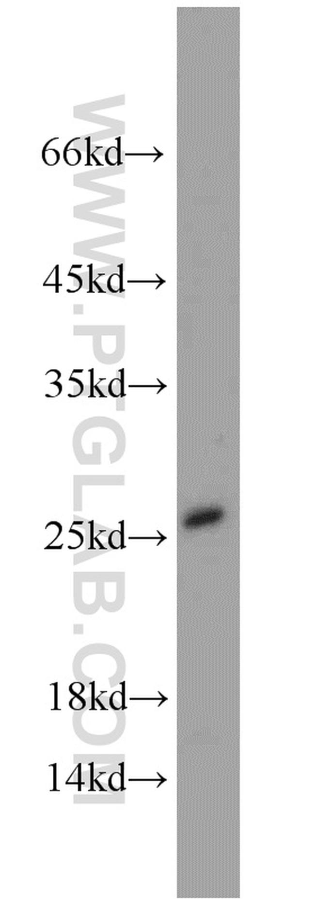 SAR1B Antibody in Western Blot (WB)